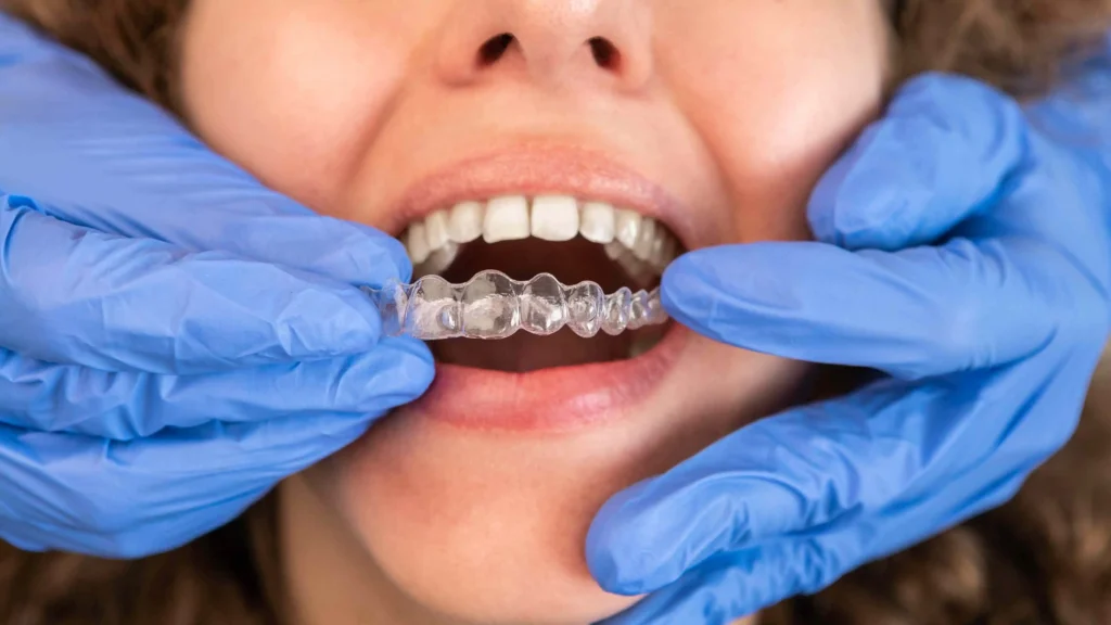 Dentist in Applying Invisible How Does Invisalign Work