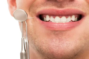 Factors Affecting the Duration of a Dental Cleaning