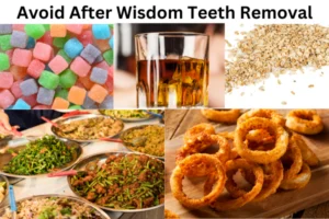 Avoid After Wisdom Teeth Removal