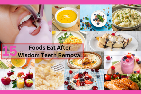 what to Eat After Wisdom Teeth Removal