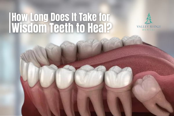 How Long Does It Take for Wisdom Teeth to Heal