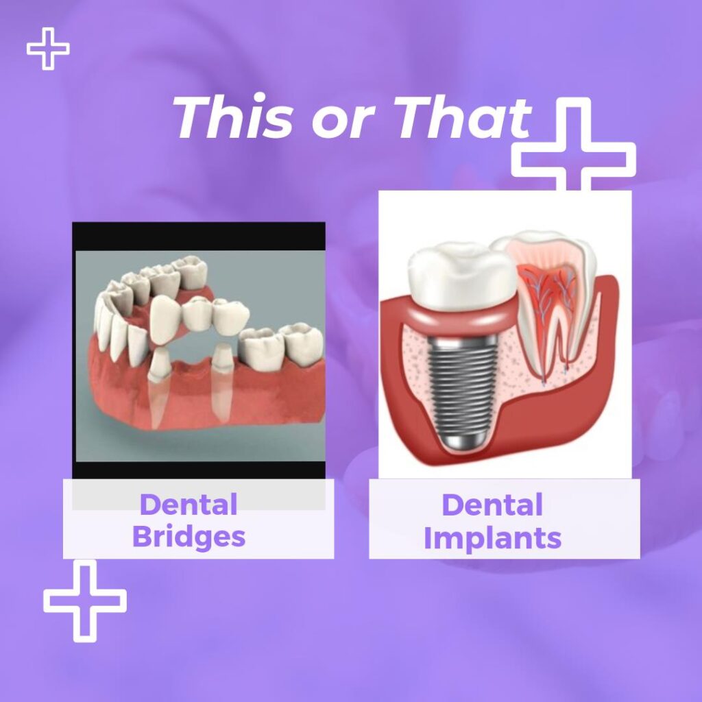 tooth implant vs dental bridge