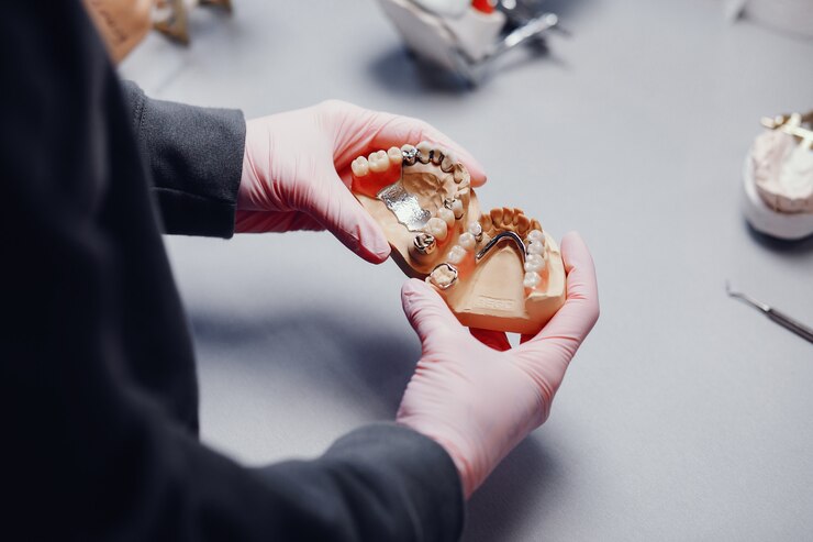 partial dentures for front teeth