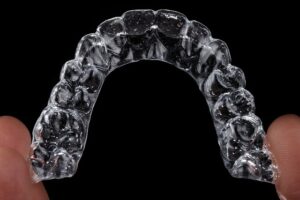 invisalign and attachments